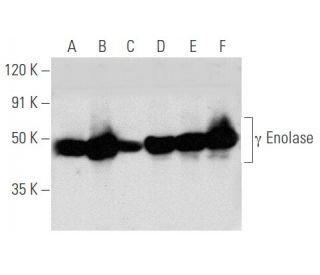 &gamma; Enolase Antibody (3F290) - Western Blotting - Image 354762 