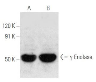 &gamma; Enolase Antibody (NSE-P2) - Western Blotting - Image 354770 