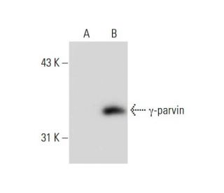 &gamma;-parvin Antibody (F-9) - Western Blotting - Image 132707