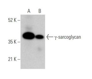 &gamma;-sarcoglycan Antibody (E-8) - Western Blotting - Image 373458 