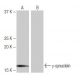 gamma Synuclein/SNCG Antibody (8H11) - Western Blotting - Image 65068