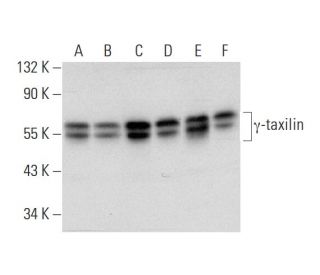 &gamma;-taxilin Antibody (A-10) - Western Blotting - Image 296979 