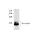 γB-crystallin Antibody (D-5) - Western Blotting - Image 299026