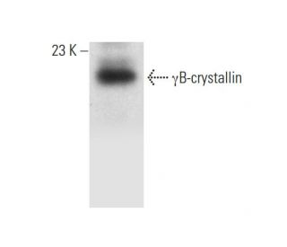 &gamma;B-crystallin Antibody (D-5) - Western Blotting - Image 318082 
