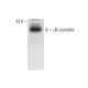 γB-crystallin Antibody (D-5) - Western Blotting - Image 318082 