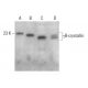 γB-crystallin Antibody (D-5) - Western Blotting - Image 376257 
