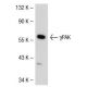 γPAK Antibody (F-12) - Western Blotting - Image 39549