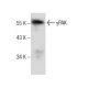 γPAK Antibody (H-4) - Western Blotting - Image 282425