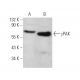 γPAK Antibody (H-4) - Western Blotting - Image 374728 