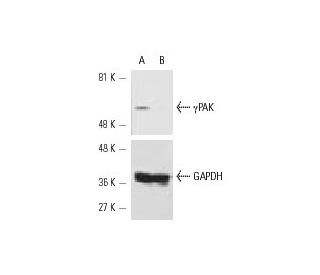 &gamma;PAK siRNA (h): sc-36183. Western blot analysis of &gamma;PAK expression in non-transfected control (A) and &gamma;P 