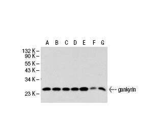gankyrin Antibody (3A6C2) - Western Blotting - Image 21340 