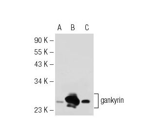 gankyrin Antibody (3A6C2) - Western Blotting - Image 51134 