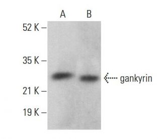 gankyrin Antibody (3A6C2) - Western Blotting - Image 360259 