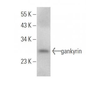 gankyrin Antibody (3A6C2) - Western Blotting - Image 363534