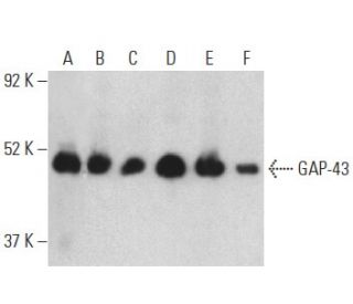 GAP-43 Antibody (7B10) - Western Blotting - Image 398863Each CRISPR/Cas9 Knockout (KO) Plasmid product consists of a pool of 3 plasmids designed to ensure identification and cleavage of a specific gene for maximum knockout efficiency. Each plasmid encodes a unique 20 nt sequence derived from the GeCKO (v2) library. 