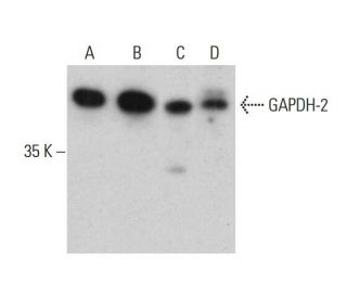 GAPDH-2 Antibody (2E3-2E10) - Western Blotting - Image 384295SAM Transcription Activation: SAM system utilizing dCas9-VP64, MS2-P65-HSF1, and sgRNA for precise gene transcription activation.