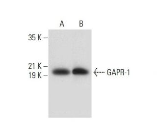 GAPR-1 Antibody (G-1) - Western Blotting - Image 305751 