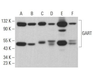 GART Antibody (F-8) - Western Blotting - Image 383081 