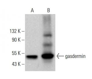 gasdermin Antibody (H-6) - Western Blotting - Image 376555 