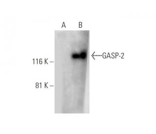 GASP-2 Antibody (F-6) - Western Blotting - Image 289015 