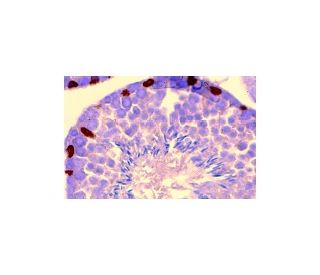 GATA-1 Antibody (N6) - Immunohistochemistry - Image 1179 