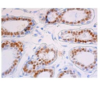 GATA3 Antibody (C-11) - Immunohistochemistry - Image 352899 