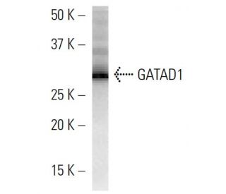 GATAD1 Antibody (GATA9A1D3) - Western Blotting - Image 16663 