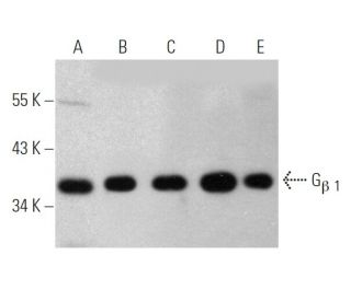 G<sub>&beta; 1</sub> Antibody (F-2) - Western Blotting - Image 363288 