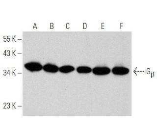 G<sub>&beta;</sub><sub> Antibody (</sub>A-4) - Western Blotting - Image 356271 