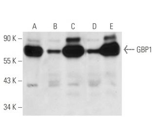 GBP1 Antibody (1B1) - Western Blotting - Image 14711 