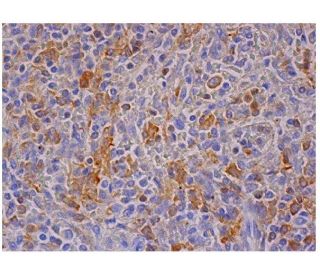 GBP2 Antibody (G-9) - Immunohistochemistry - Image 285710 