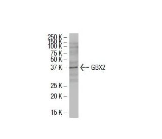 GBX2 Antibody (BB-9) - Western Blotting - Image 33613Each CRISPR/Cas9 Knockout (KO) Plasmid product consists of a pool of 3 plasmids designed to ensure identification and cleavage of a specific gene for maximum knockout efficiency. Each plasmid encodes a unique 20 nt sequence derived from the GeCKO (v2) library.