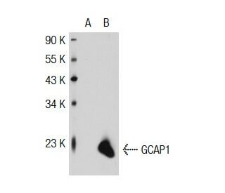 GCAP1 Antibody (G2G4) - Western Blotting - Image 32396 
