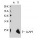 GCAP1 Antibody (G2G4) - Western Blotting - Image 32396 