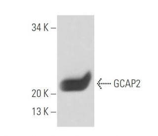 GCAP2 Antibody (A1) - Western Blotting - Image 15657