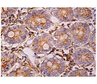 GCAP2 Antibody (B-8) - Immunohistochemistry - Image 159991 