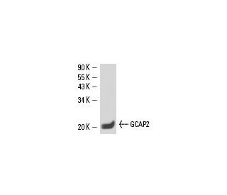 GCAP2 Antibody (F6) - Western Blotting - Image 15658 