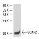 GCAP2 Antibody (F6) - Western Blotting - Image 15658 