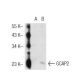 GCAP2 Antibody (F6) - Western Blotting - Image 42457