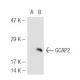 GCAP2 Antibody (F6) - Western Blotting - Image 46365 