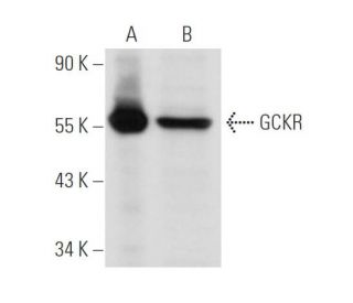 GCKR Antibody (A-8) - Western Blotting - Image 30491