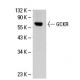 GCKR Antibody (G-6) - Western Blotting - Image 19557