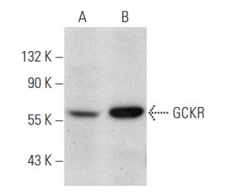 GCKR Antibody (B-9) - Western Blotting - Image 354418The Double Nickase Plasmid features a U6 promoter for sgRNA expression, a 20 nt targeting sequence, and a gRNA scaffold to guide Cas9n. It includes a CBh promoter for Cas9n (D10A) and puromycin resistance, GFP for transfection verification, and nuclear localization signals (NLS). The 2A peptide allows co-expression of Cas9n and Puro from a single promoter, enabling precise genome editing with reduced off-target effects.