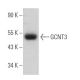GCNT3 Antibody (D-7) - Western Blotting - Image 367735 