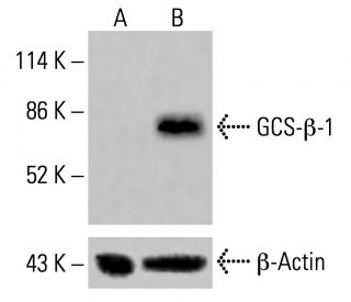 GCS-β-1 Antibody (G-3) - Western Blotting - Image 415616