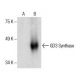 GD3 Synthase Antibody (B-11) - Western Blotting - Image 286095 