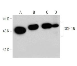 GDF-15 Antibody (H-2) - Western Blotting - Image 356257The Double Nickase Plasmid features a U6 promoter for sgRNA expression, a 20 nt targeting sequence, and a gRNA scaffold to guide Cas9n. It includes a CBh promoter for Cas9n (D10A) and puromycin resistance, GFP for transfection verification, and nuclear localization signals (NLS). The 2A peptide allows co-expression of Cas9n and Puro from a single promoter, enabling precise genome editing with reduced off-target effects.