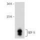 GDF-5/6/7/16 Antibody (A-2) - Western Blotting - Image 148986