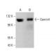 Gemin4 Antibody (17D10) - Western Blotting - Image 379214