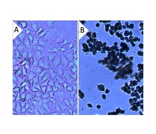 Geneticin (G418) Sulfate: sc-29065. Cultured HeLa cells treated with 0&mu;g/ml (A) and 8&mu;g/ml (B) Geneticin (G418) Sulf 
